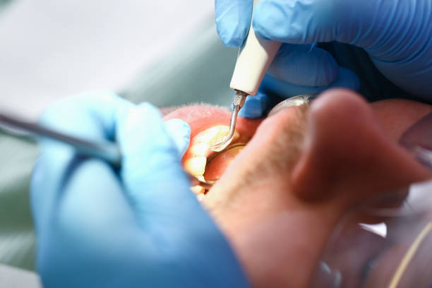 Best Same-Day Emergency Dentist in Raymond, IL