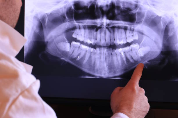 Best Emergency Tooth Extraction in Raymond, IL